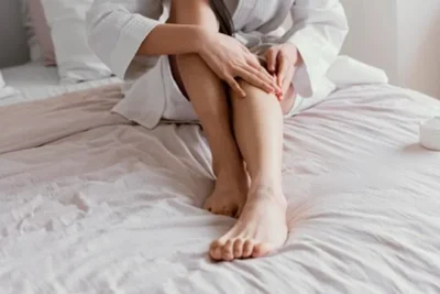 varicose vein"