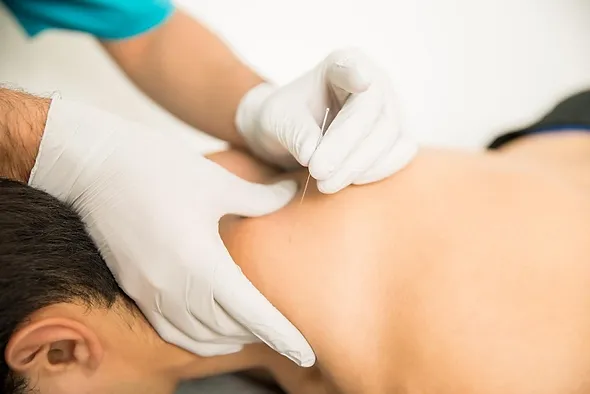 acupuncturing girl