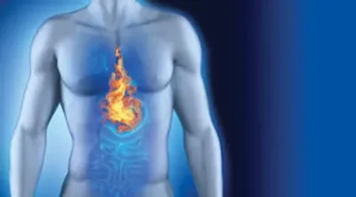 Illustration of a human torso with a flame rising from the stomach to the chest, symbolizing heartburn or acid reflux against a blue background.